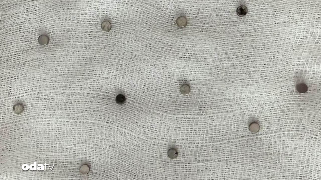 3 yasindaki cocuktan 19 miknatis cikti 1SXqvUGt